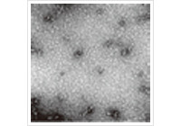 アルツハイマー病アミロイドβの
会合体の電子顕微鏡写真