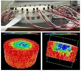 電気インピーダンスCTによる体脂肪分布計測